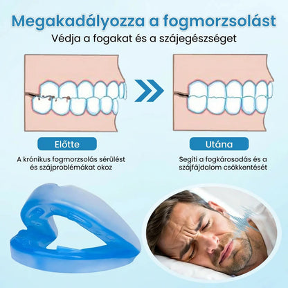 Alváskomfort Szájbetét